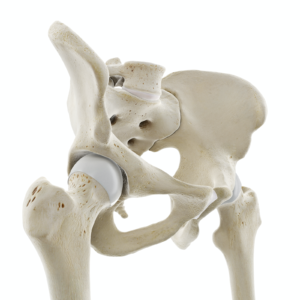 A model of hip bones showing the hip joint.